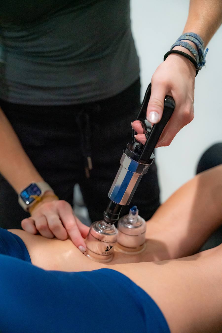 Cupping